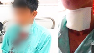 Video: Công an điều tra vụ tài xế GrabBike bị cướp cứa cổ ở Nha Trang