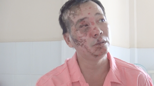 Video: Suýt hỏng mặt vì bột thông cống