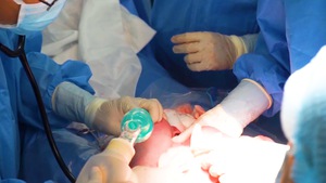Video: 2 bệnh viện phối hợp cứu bé sơ sinh bị khối bướu 'bạch huyết khủng' hiếm gặp