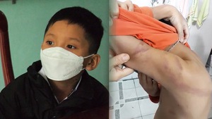 Video: Phạt người cha 'dạy con bằng đòn roi chằng chịt' ở Quảng Nam 1,5 triệu đồng