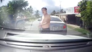Video: Bấm còi khi thấy xe khác đang lùi, tài xế bị đánh rách môi, chảy máu răng