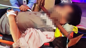 Video: Cứu sống nam công nhân ngã vào giàn giáo bị thanh sắt dài 30cm đâm xuyên cổ