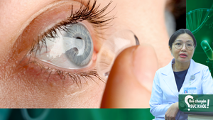 Đeo kính áp tròng qua đêm hoặc gặp mưa, mắt có bị ảnh hưởng không?