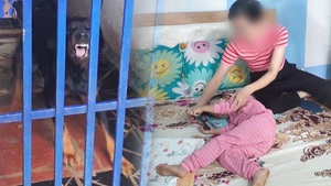 Bé gái 3 tuổi bị cặp chó becgie nhà hàng xóm cắn, phải cấp cứu khâu 16 mũi
