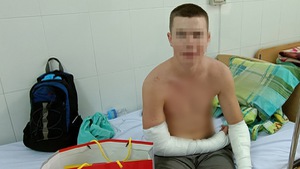 Video: Con chó cắn du khách nước ngoài ở Nha Trang trước đó đã cắn nhiều người