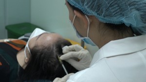 Góc nhìn trưa nay | Rụng tóc bất thường, coi chừng bệnh lý