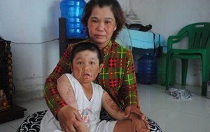 Hai bài học từ cơn sốt giá thịt heo