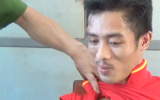 Video: Đối tượng phê ma túy đánh trưởng Công an xã bị thương