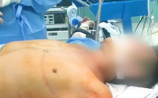 Video: Cứu người đàn ông tự dùng kéo đâm vào cổ