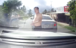 Video: Bấm còi khi thấy xe khác đang lùi, tài xế bị đánh rách môi, chảy máu răng