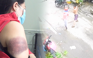 Video: Vụ dùng gậy đánh người phụ nữ vì con chó, đề xuất cho thôi việc một bảo vệ dân phố