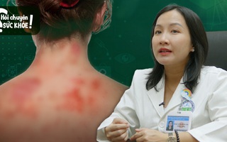 Bắt tay, tiếp xúc trực tiếp có thể lây bệnh ghẻ lở