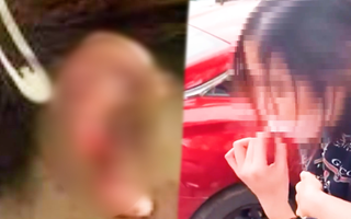 Video: Người phụ nữ cắn đứt tai cô gái vì ghen tuông ở Thanh Hóa bị khởi tố