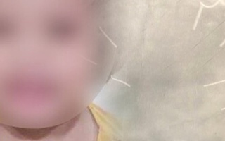 Video: Khám nghiệm tử thi, tìm thấy 10 chiếc đinh 2cm trong hộp sọ bé gái bị bạo hành