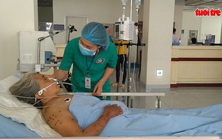 Cứu sống cụ bà bị ong đốt 200 mũi nguy kịch
