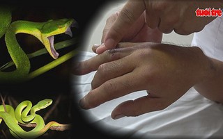 Cẩn trọng với vết rắn cắn