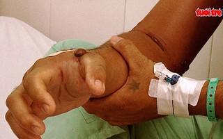 Mùa mưa, coi chừng bị rắn cắn