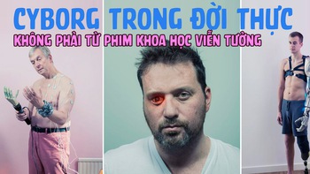 Không phải từ phim khoa học viễn tưởng, sau đây đều là người thật