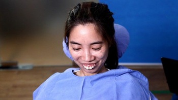 Sống trong hình hài 'Thị Nở' suốt 30 năm, cô gái Phú Thọ hóa  xinh ngoạn mục nhờ 'bạo gan' phẫu thuật thẩm mỹ