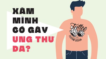 Xăm mình có gây ung thư da?