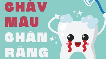 Chảy máu chân răng- triệu chứng xuất huyết não?