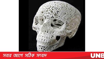 Trung Quốc: in hộp sọ 3D giúp chữa bệnh nguy hiểm về sọ