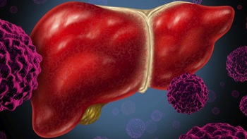 Điều trị tốt viêm gan B làm giảm tỷ lệ mắc ung thư gan