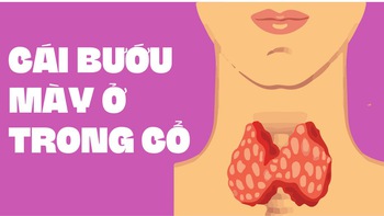 Thiếu vitamin A cũng có thể gây bướu cổ