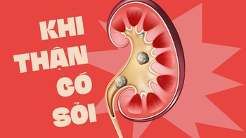 Làm sao biết mình bị sỏi thận?