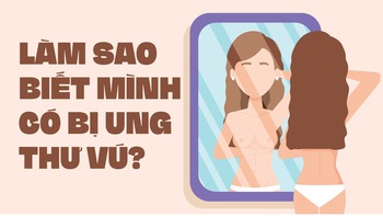 Làm sao biết mình có bị ung thư vú gọi tên?