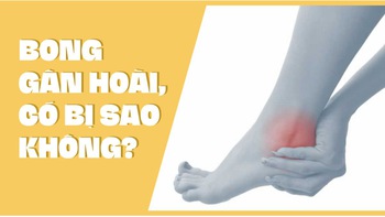 Bong gân hoài, có bị sao không?