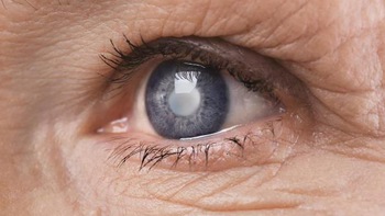Mắt bị chấm đen lởn vởn phía trước là bệnh gì?