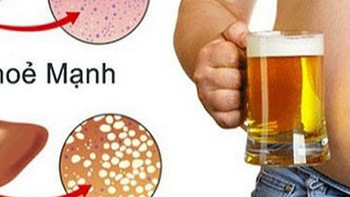 Uống rượu bia mau say hơn trước, gan đã có chuyện gì?