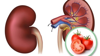 Ăn cà chua chỉ tốt khi đúng đối tượng, ăn sai dẫn đến 5 tác hại