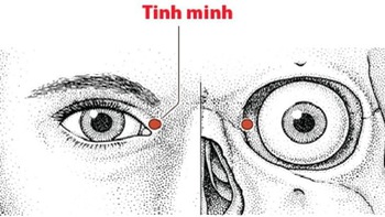 4 cách bấm huyệt đơn giản làm giảm đau mắt, cải thiện thị lực