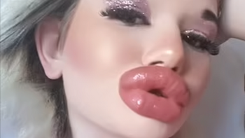 Cô gái muốn bơm môi lần thứ 27 để sở hữu vẻ đẹp tựa búp bê