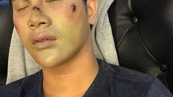 Mỹ nam Trần Phong gây ám ảnh với vai xác chết trong 'Rừng thế mạng'