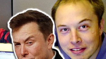 Tại sao Elon Musk trị được chứng hói đầu?