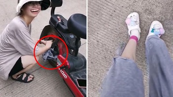 Cô gái bị bánh xe đạp điện xé rách quần