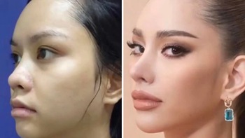 Netizen cười cợt hình ảnh chưa 'dao kéo' của tân Hoa hậu Hoàn vũ Thái Lan