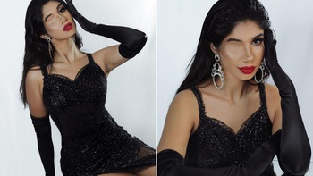 Người đẹp chỉ có một mắt thi Hoa hậu Siêu quốc gia Paraguay