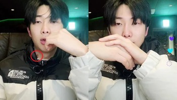 RM BTS lộ hickey - ‘dấu vết tình yêu’ trên sóng livestream