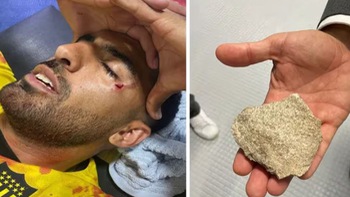 Cầu thủ Uruguay nổi điên vì đang đá dưới sân bỗng… rách mặt