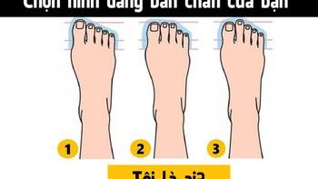 Hình dáng bàn chân nói gì về bạn?