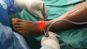 Điều trị hiệu quả chấn thương