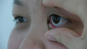 ​Tổn thương mắt do đái tháo đường