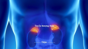 Tuyến thượng thận mệt mỏi
