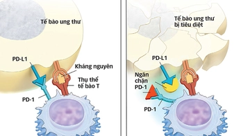 Ý nghĩa thật cho bệnh nhân ung thư