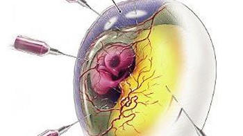 Hàng triệu quả trứng quý  đành vô dụng trước virus corona