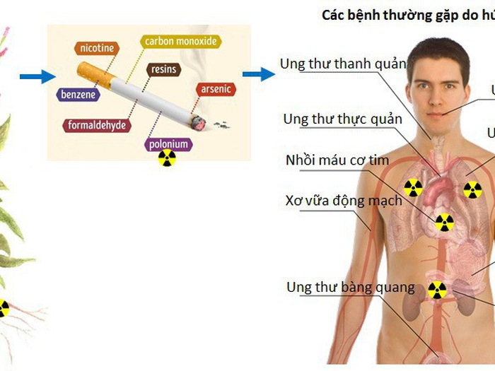 Ảnh Hưởng Của Chất Phóng Xạ Đến Sức Khỏe